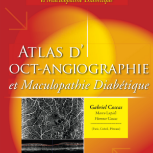 Atlas d’OCT-Angiographie et Maculopathie Diabétique