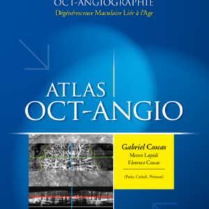 Atlas d’OCT-Angiographie et Dégénérescence Maculaire Liée à l’Age