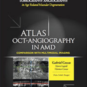 Atlas of OCT-Angiography in AMD