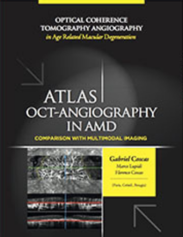 Atlas of OCT-Angiography in AMD