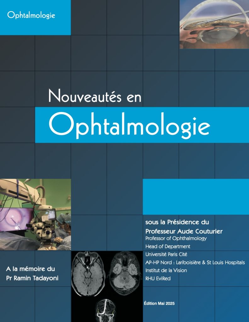 E-book | Nouveautés en Ophtalmologie 2025
