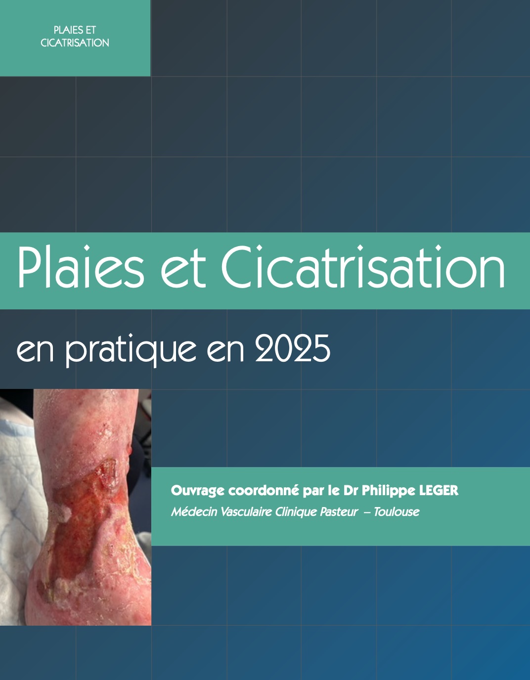 Plaies et Cicatrisation en pratique en 2025 Plaies et Cicatrisation en pratique en 2025
